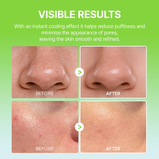 Summer Exclusive | 10-Step Skin Renewal Routine Set